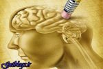 میزان افسردگی در زنان زیاد از مردان است ، یک درصد جمعیت کشور آلزایمر دارند